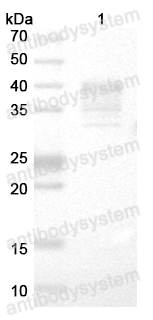 Mouse Anti-Monkeypox virus/MPXV E8L Antibody (SAA0285)